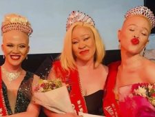 Zuid-Afrikaanse Shabangu is trots op haar albinisme