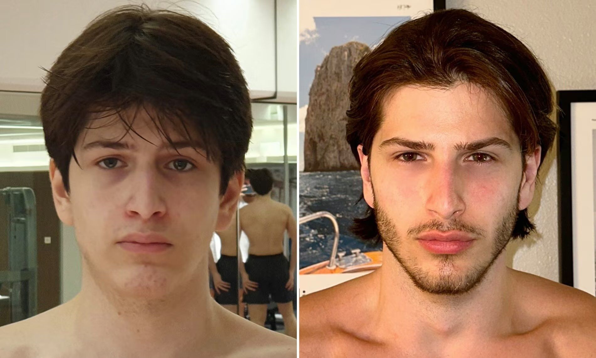 Hoe ‘looksmaxxing’ het gezicht van jonge mannen verandert | 360 Magazine