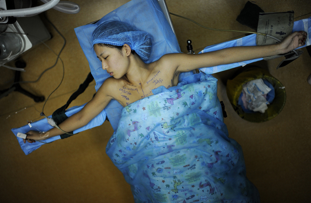 De 21-jarige Feifei krijgt een borstimplantatie in het ziekenhuis in het Chinese Hefei. De jonge vrouw is derdejaarsstudente en parttimemodel. Ze kreeg een gratis borstvergrotende operatie à 48.880 dollar in ruil voor reclame voor het ziekenhuis.
